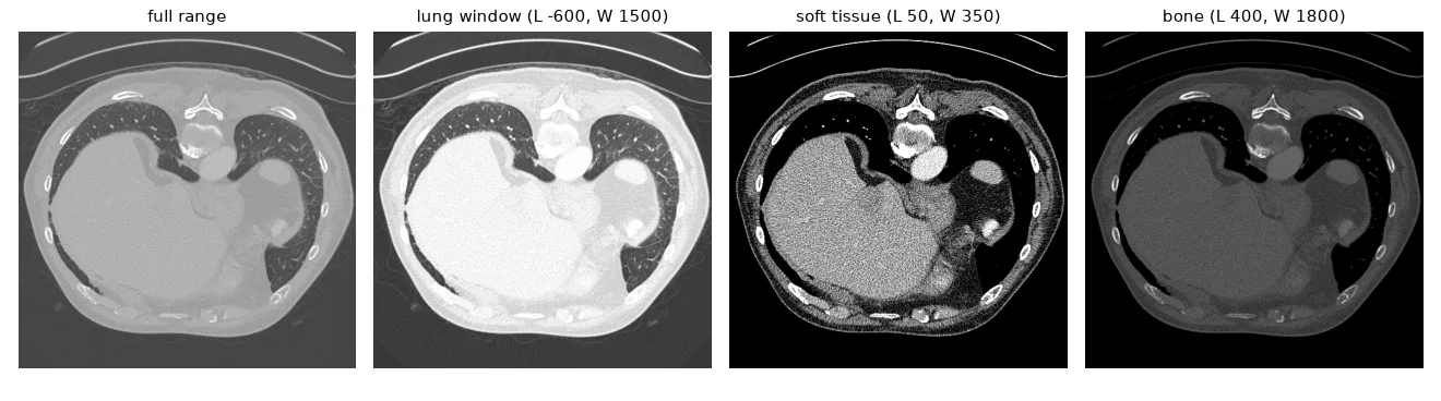 The same slice with four windows. The full range wastes the screen's 256 levels; the lung window shows the airways and vessels, the soft-tissue window the heart and muscles.